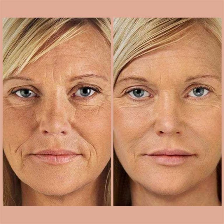 anti aging skin